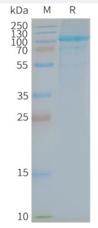 SDS-PAGE (TLR5-2038H).jpg